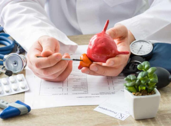 Esame delle urine per diagnosticare il tumore alla prostata