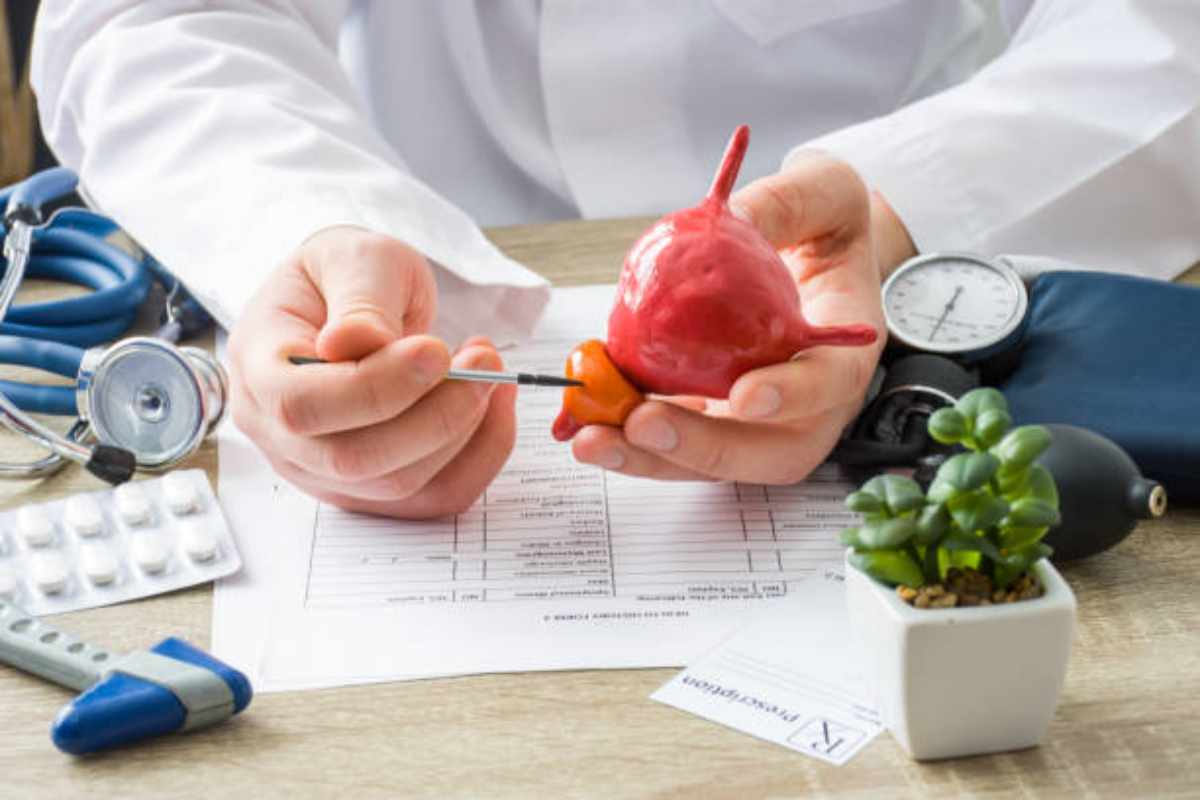 Esame delle urine per diagnosticare il tumore alla prostata