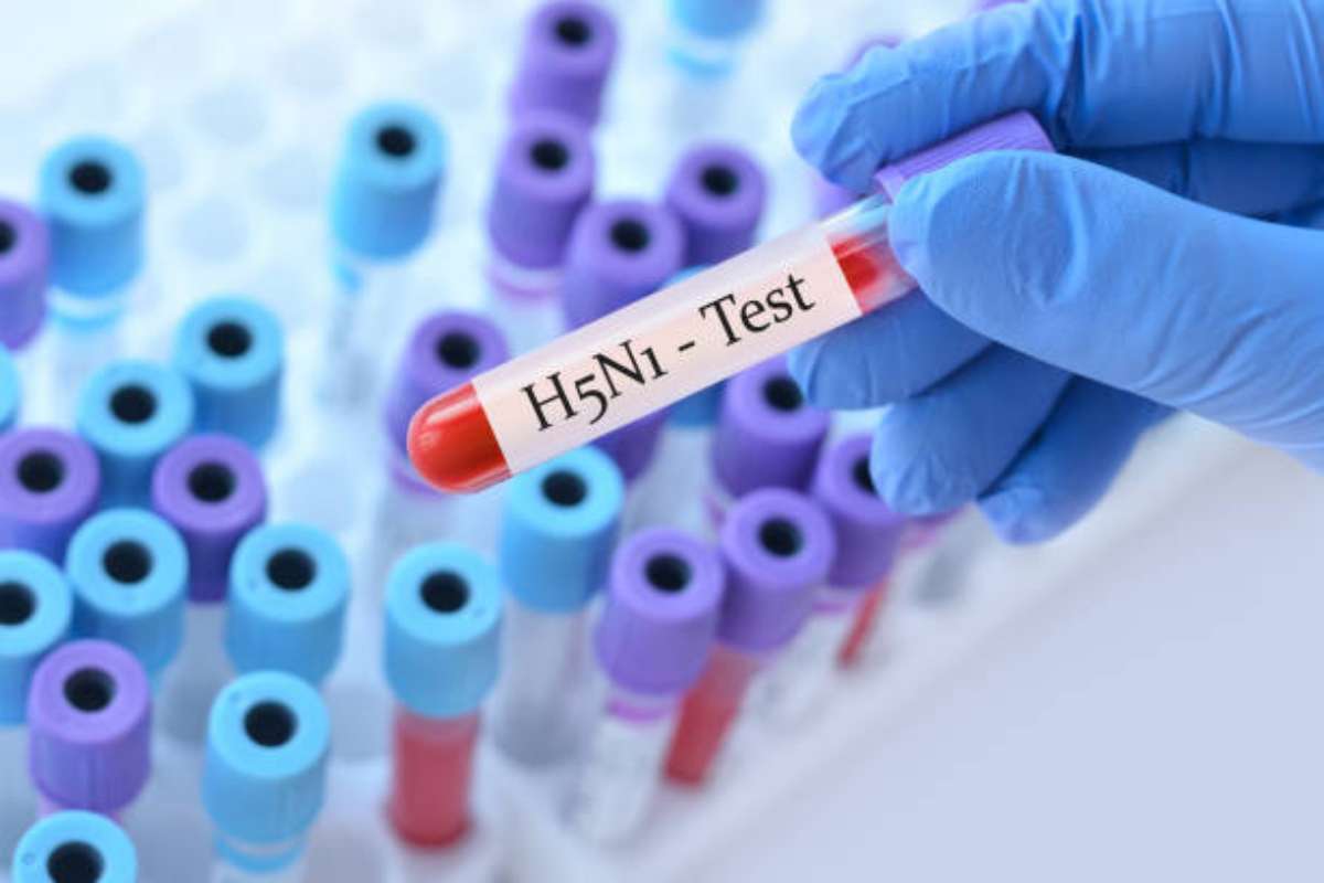 Allarme pandemia influenza aviaria
