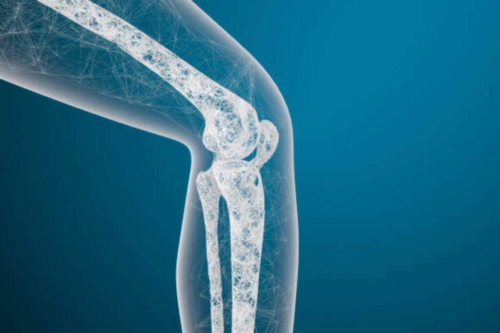 Campagna informativa sull'osteoporosi in Italia