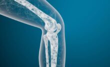 Campagna informativa sull'osteoporosi in Italia