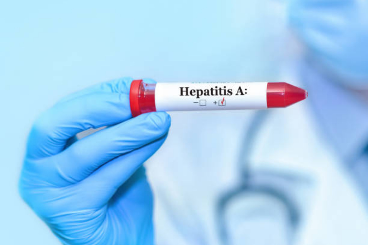Epatite A: come si diffonde e le sue caratteristiche