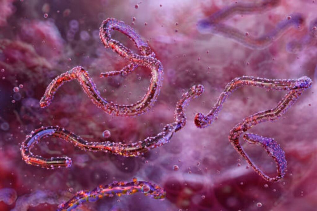 Febbre emorragica di Marburg