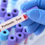 La pertosse torna a spaventare il mondo