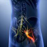 Rappresentazione 3D del nervo sciatico