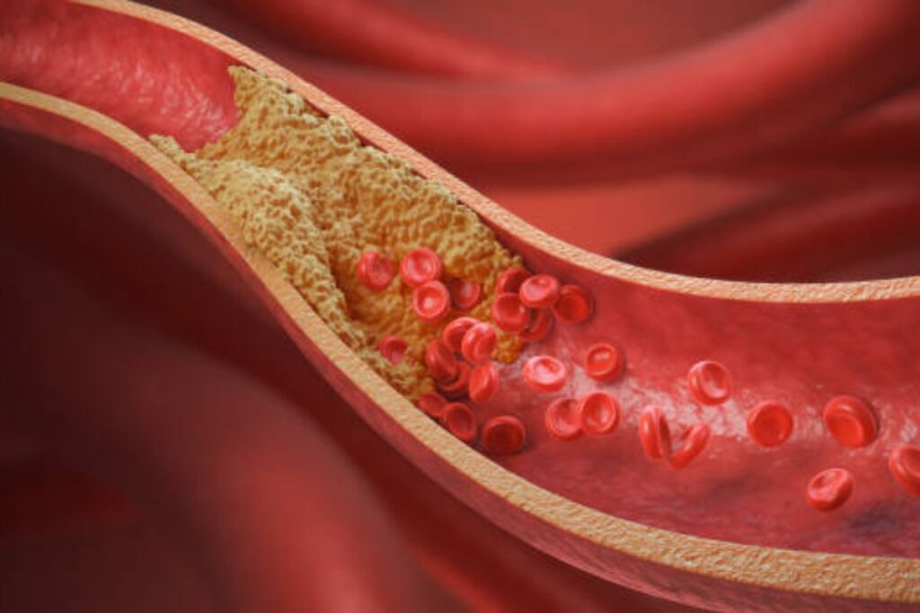 Colesterolo: l'importanza della qualità dei grassi