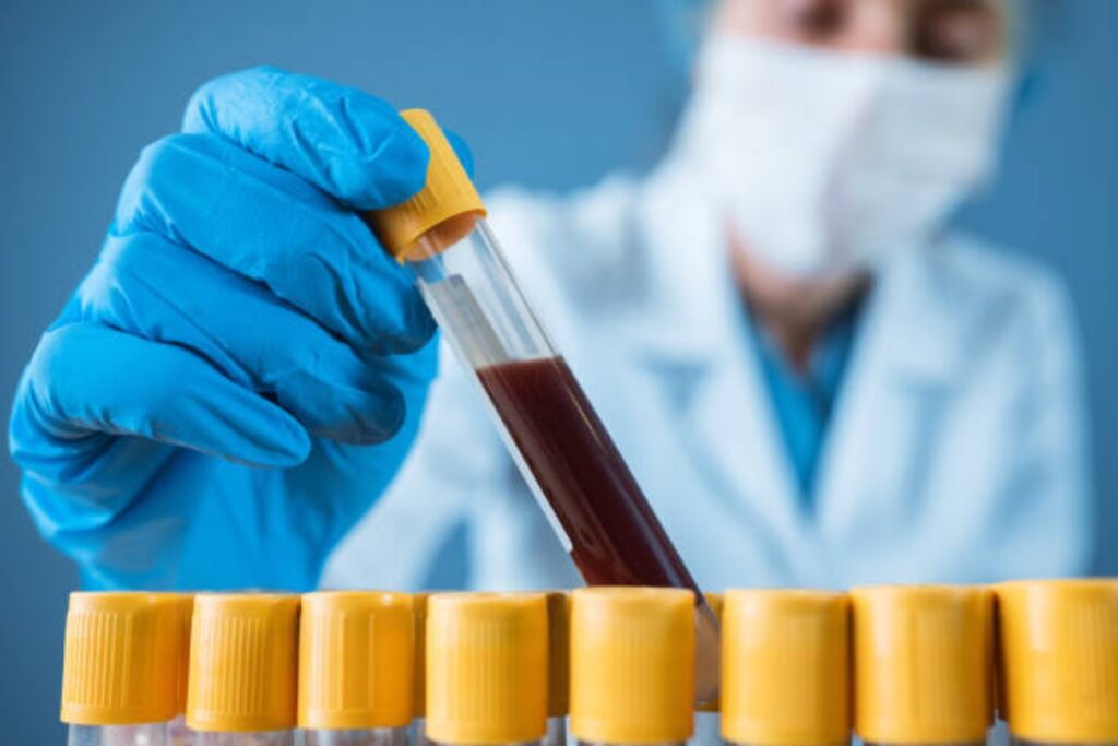 Nel sangue la risposta ai farmaci per la schizofrenia