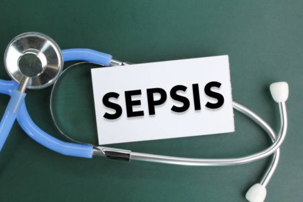 Sepsi