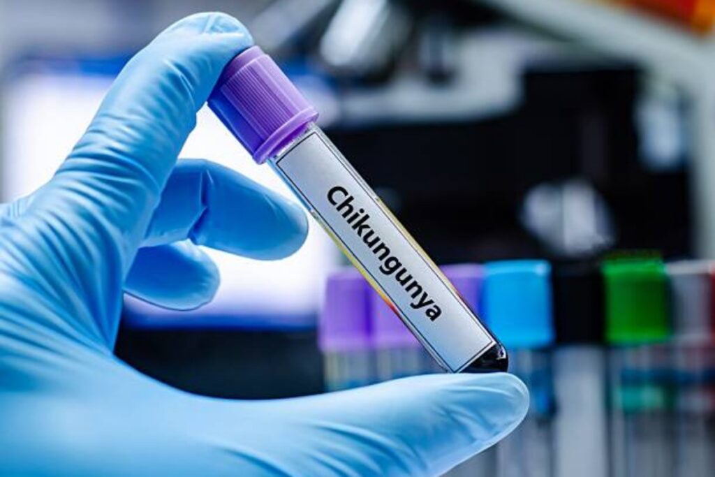 Virus Chikungunya
