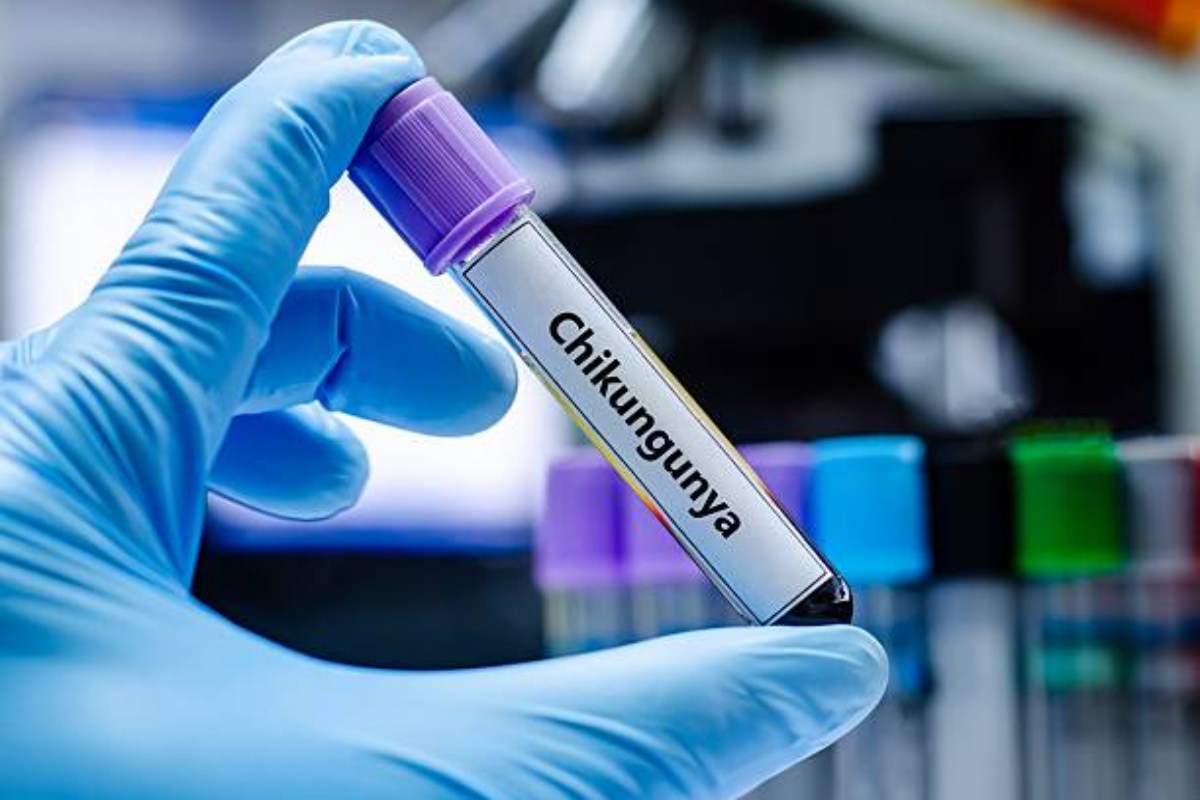 Virus Chikungunya