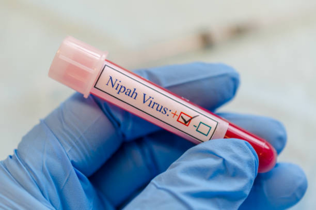 Virus Nipah