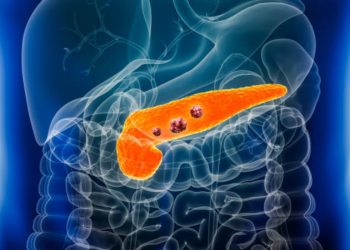 Problema al pancreas