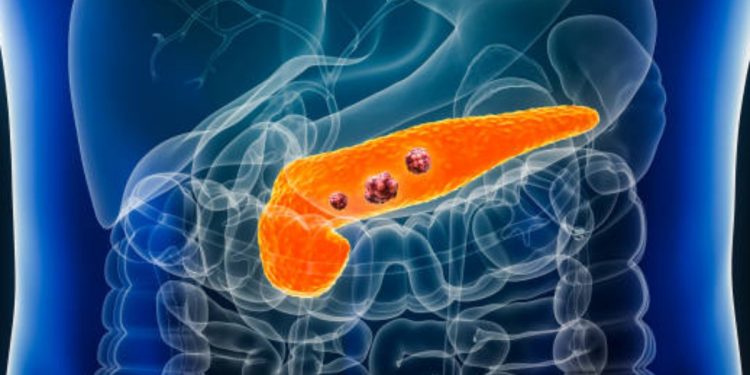 Problema al pancreas