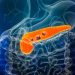 Problema al pancreas