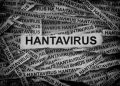 Hantavirus
