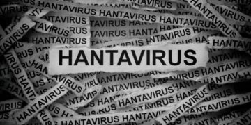 Hantavirus