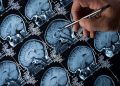 Tumori del cervello pediatrici